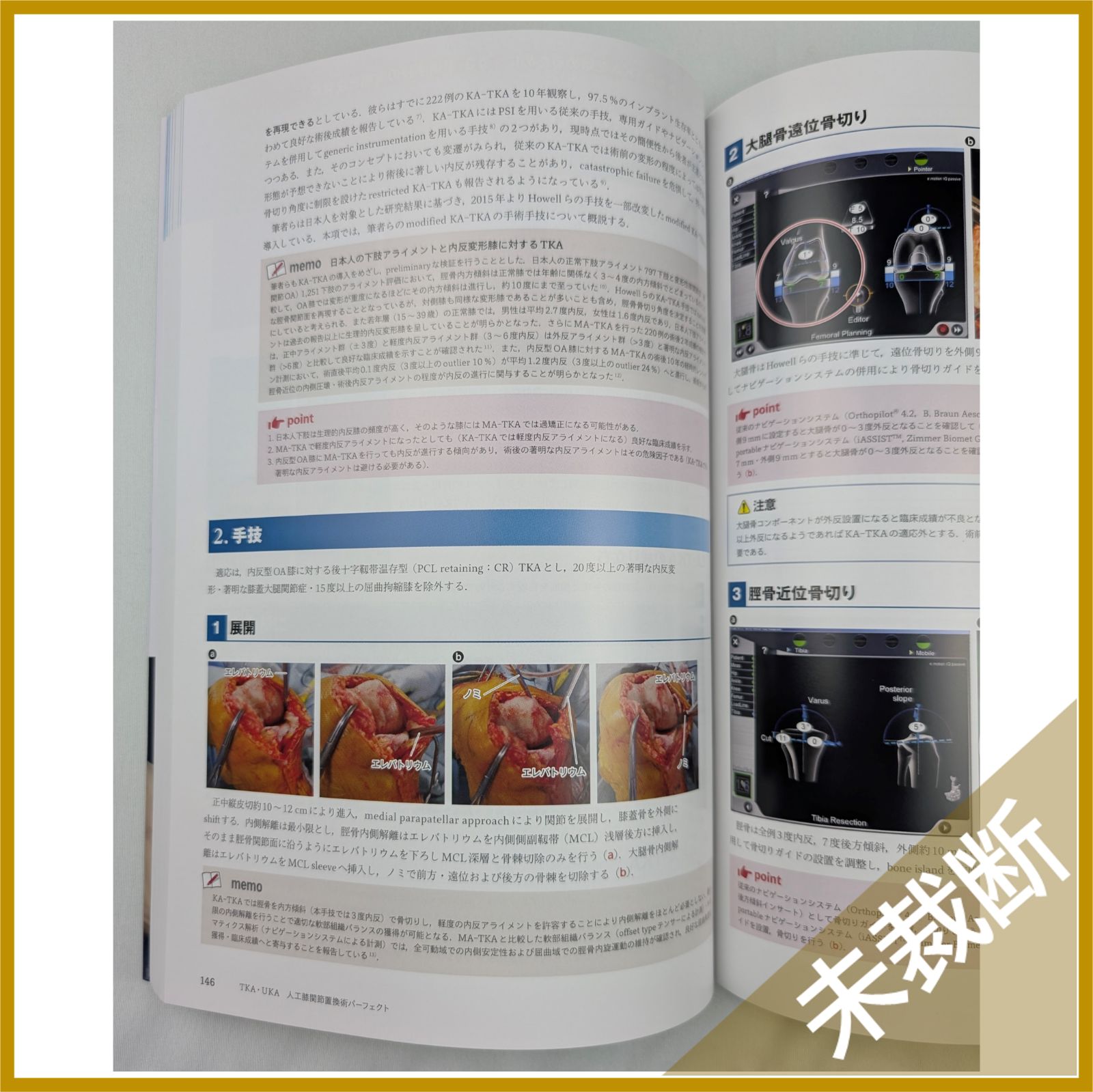 人工膝関節置換術パーフェクト 人工膝関節全置換術