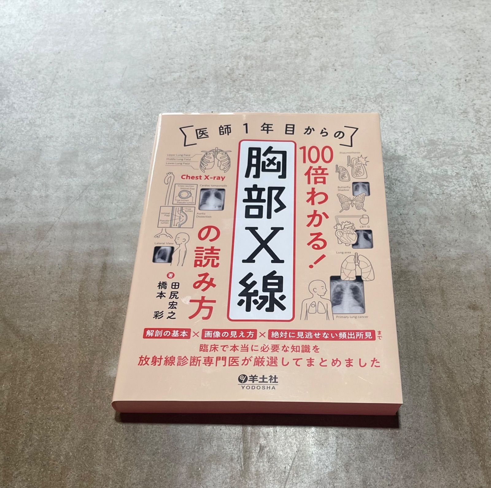 医師1年目からの 100倍わかる! 胸部X線の読み方