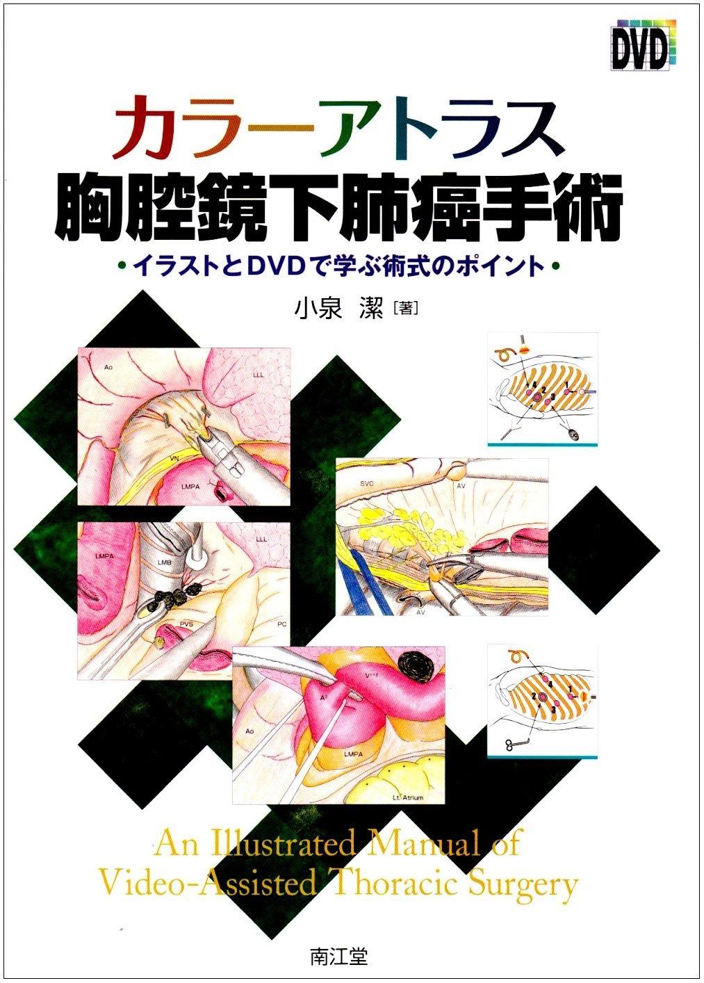 カラーアトラス胸腔鏡下肺癌手術 イラストとDVDで学ぶ術式のポイント カラーアトラス胸腔鏡下肺癌手術 - メルカリ