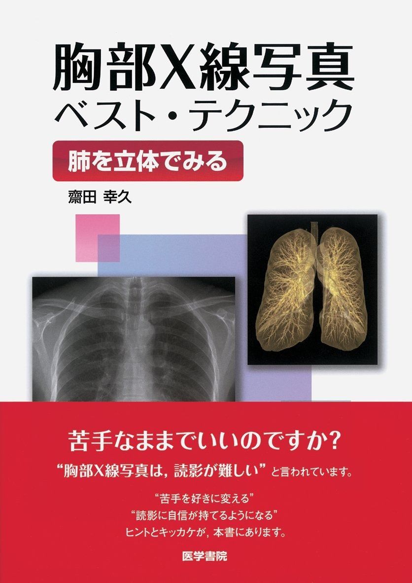 B.C.Rich フライングV （黒）】