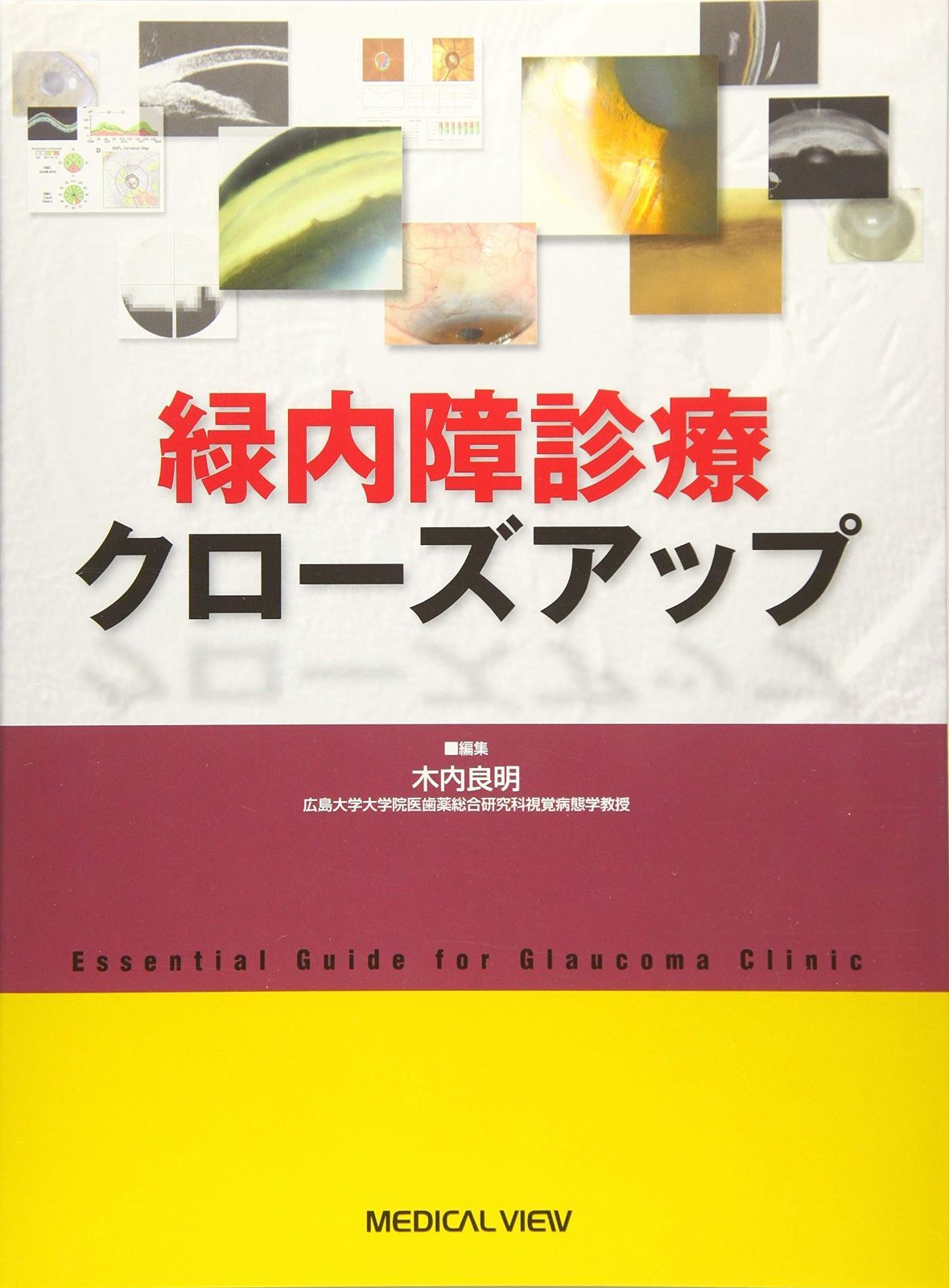 緑内障診療クローズアップ 【公式通販】