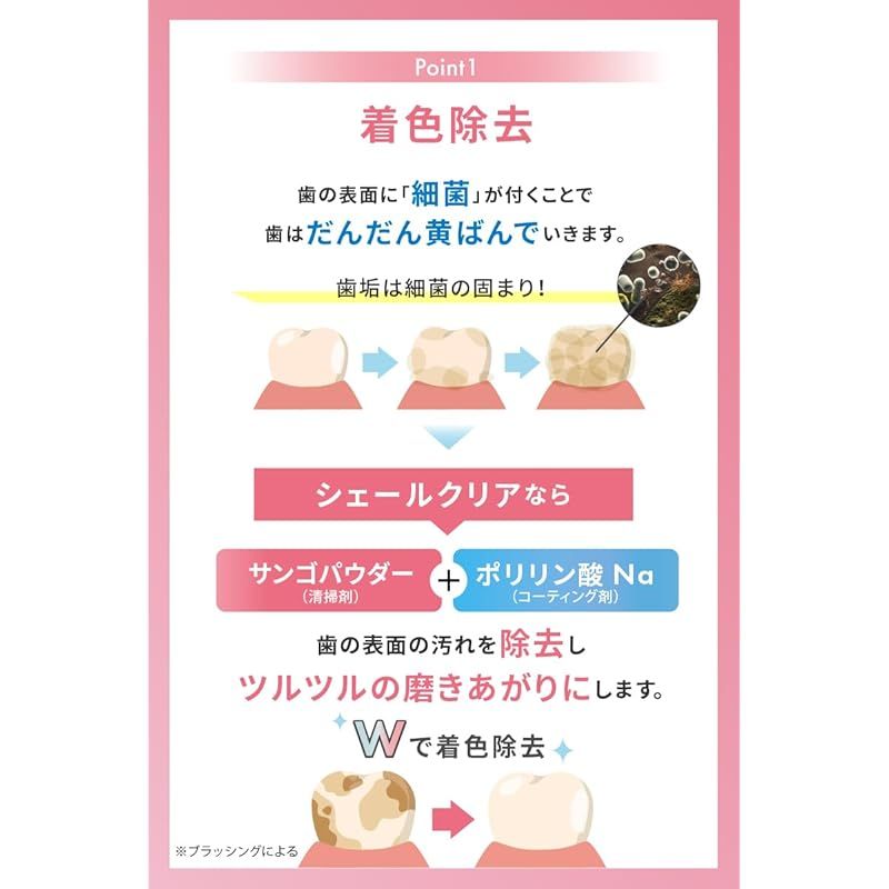 歯 白く美白