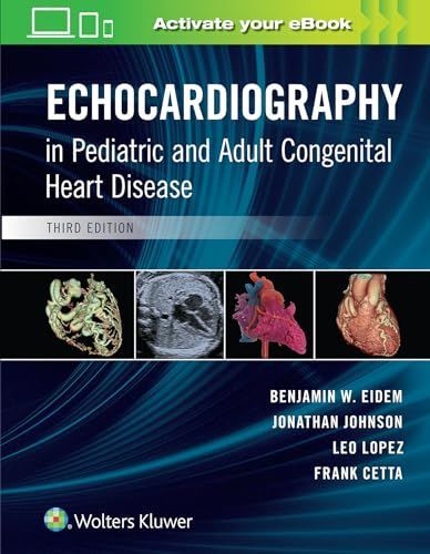 Echocardiography in Pediatric and Adult Congenital Heart Disease [ハードカバー] Eidem MD  FACC  FASE， Benjamin W.、 Cetta MD  FACC  FASE，