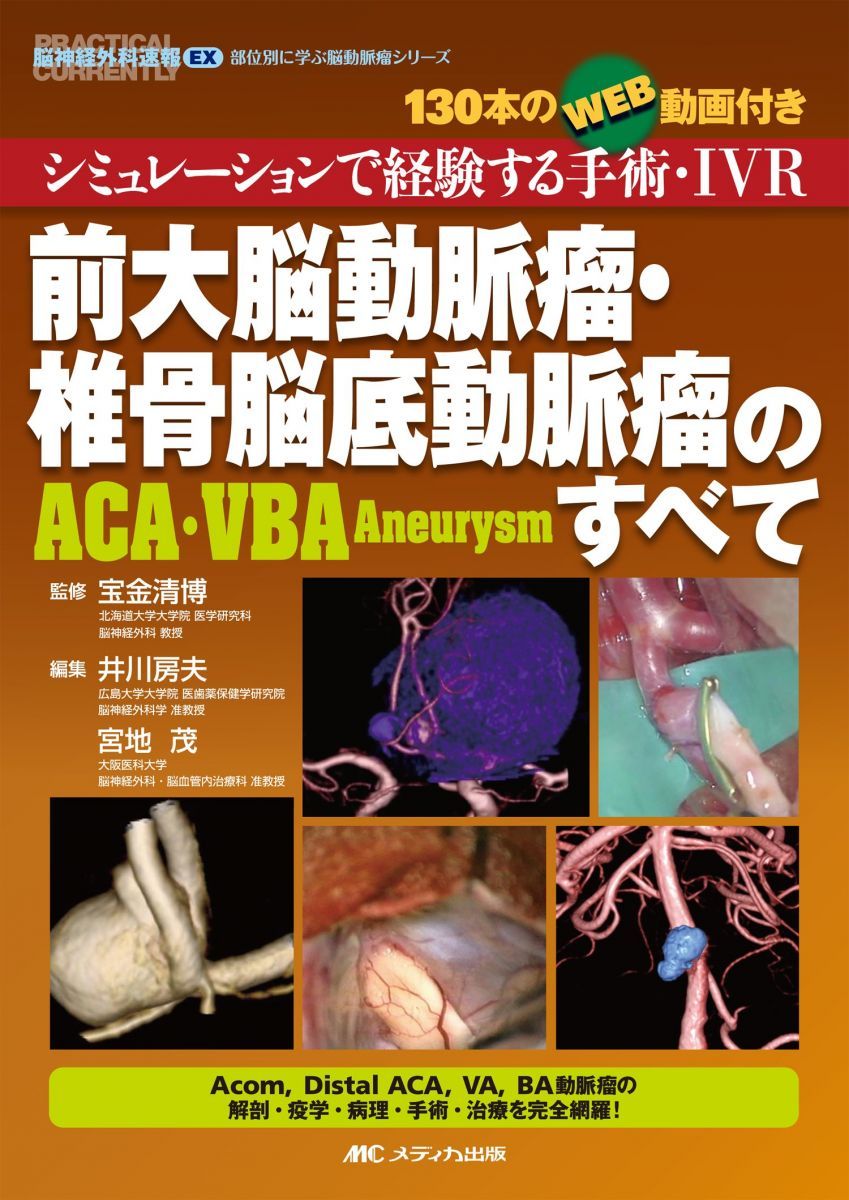 中大脳動脈瘤(MCA Aneurysm)のすべて シミュレーションで経験する手… 中大脳動脈瘤(MCA Aneurysm)のすべて: シミュレーションで経験