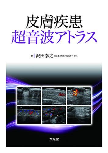 皮膚疾患超音波アトラス／沢田泰之