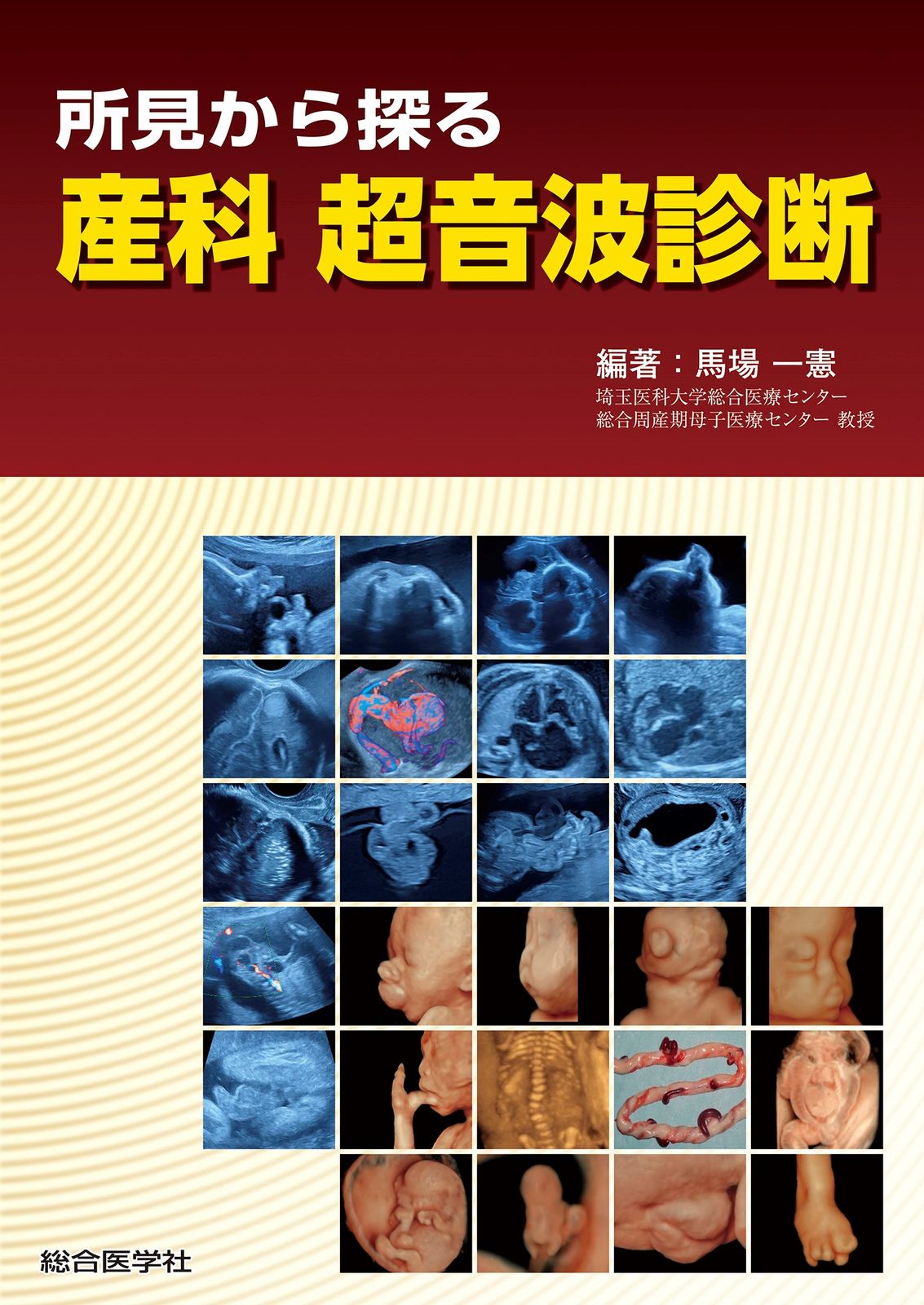 所見から探る産科超音波診断 総合医学社 馬場一憲 単行本