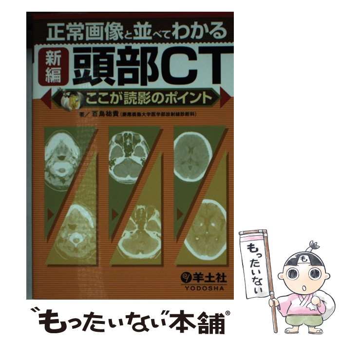 【中古】 正常画像と並べてわかる新編頭部CT ここが読影のポイント / 百島 祐貴 / 羊土社