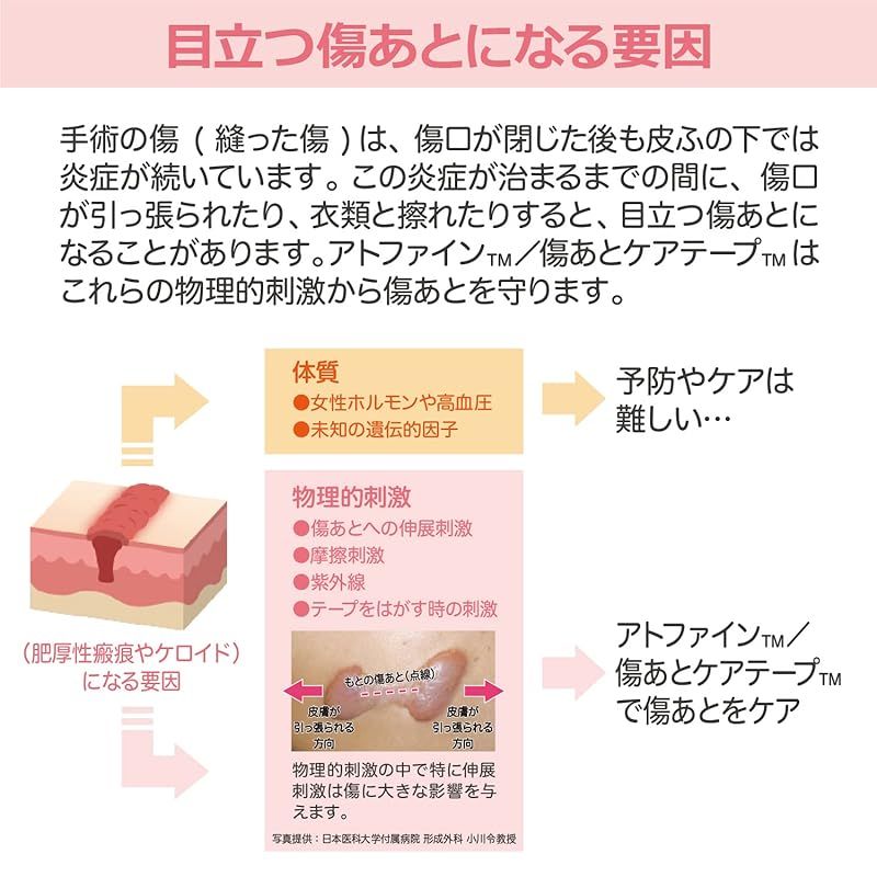 アトファイン 傷あとケアテープ