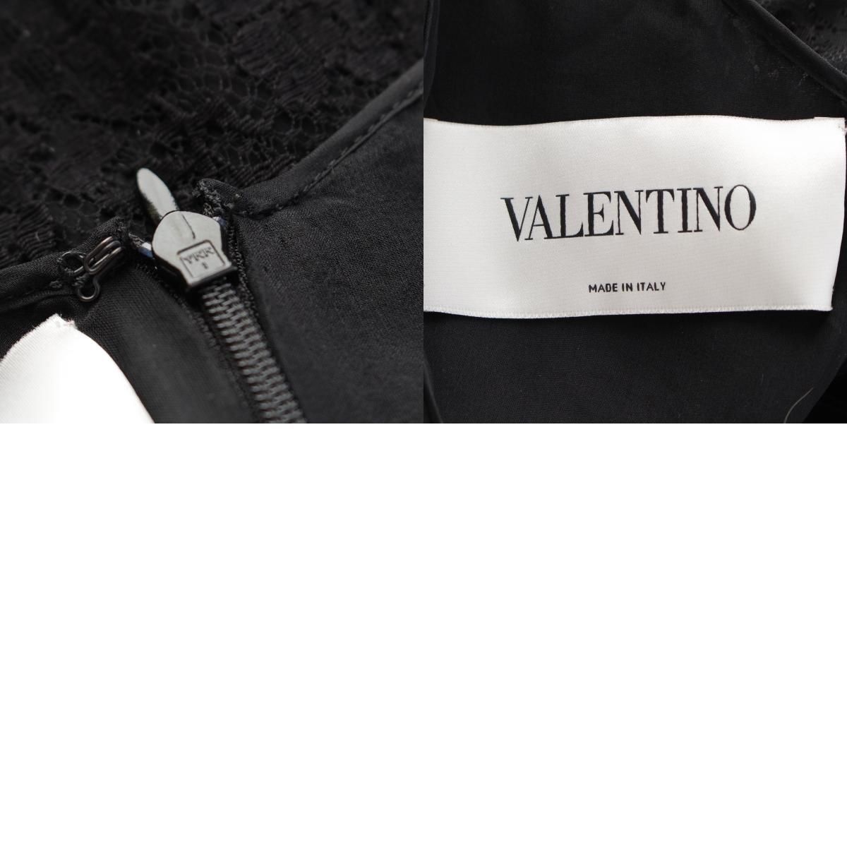 ワンピース セット