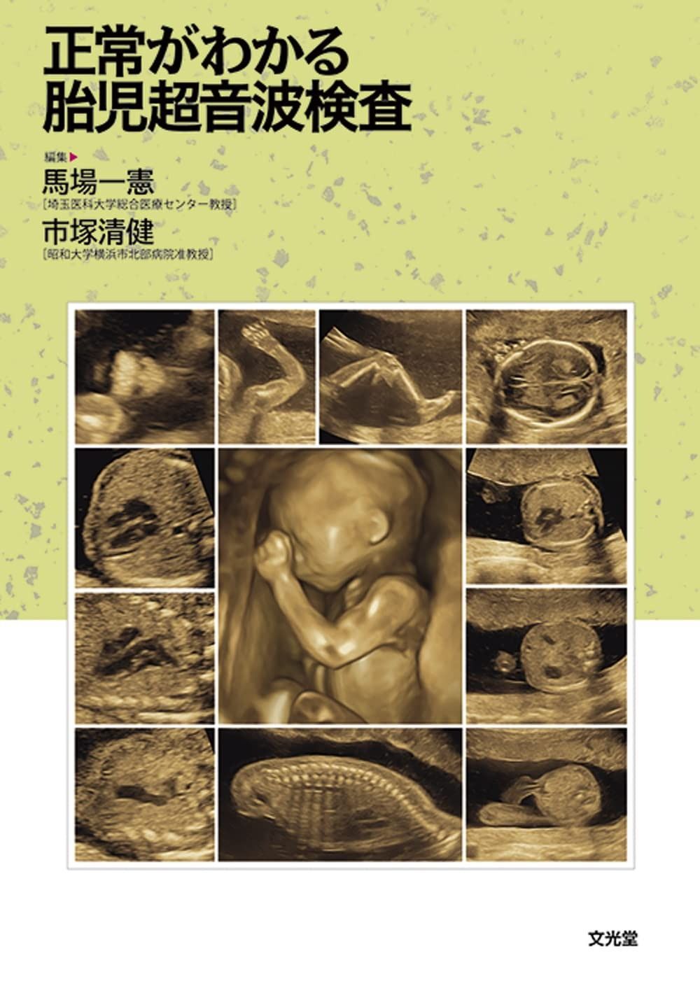 2025，セール 正常がわかる胎児超音波検査 その他