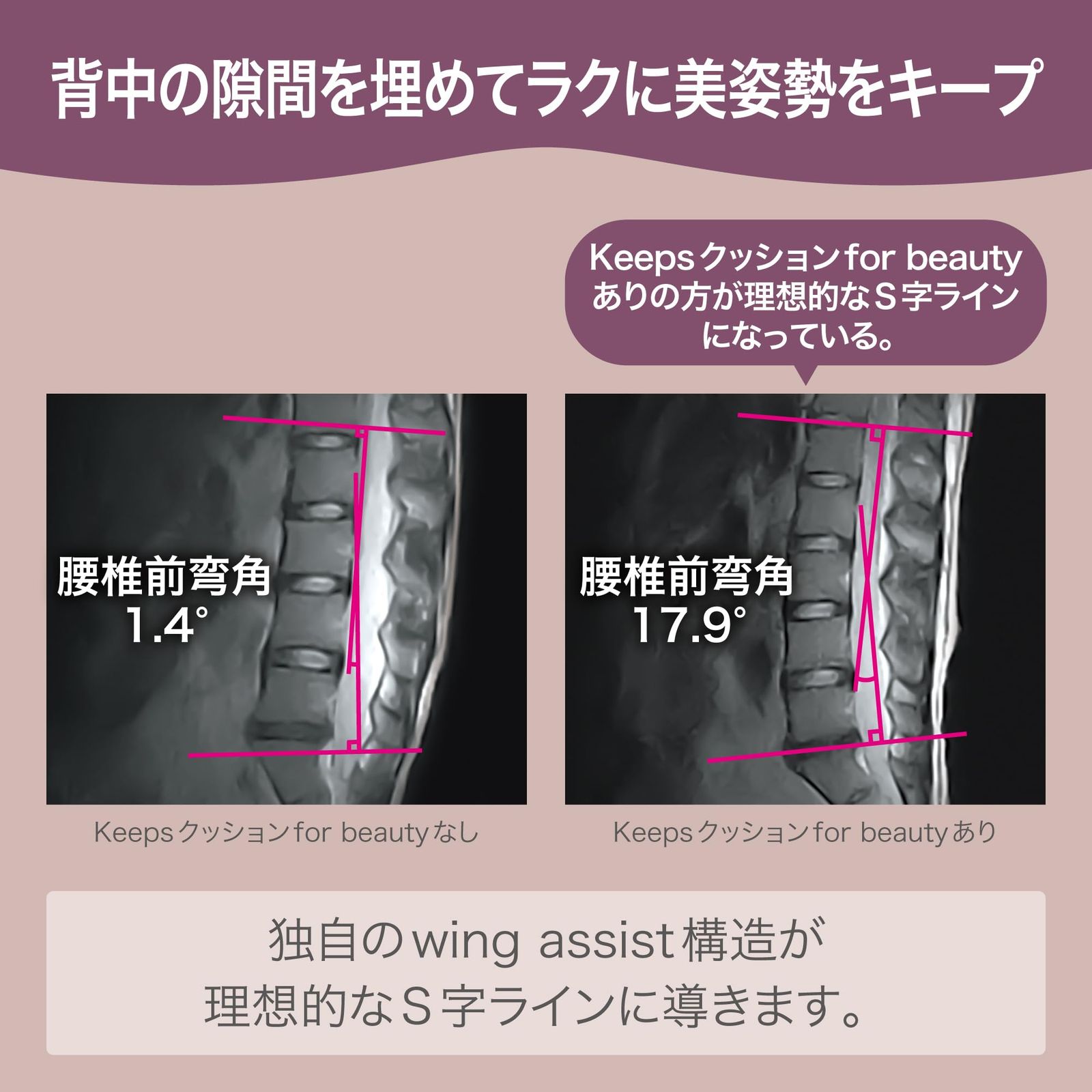 レビュー nishikawa 西川 キープス クッション for beauty 骨盤サポートクッション 骨盤を優しく支え ラクに美しい姿勢をキープ 坐骨に集中する圧力を分散 座布団 シートクッション チェアクッション 40X39X28cm Keeps ネイ