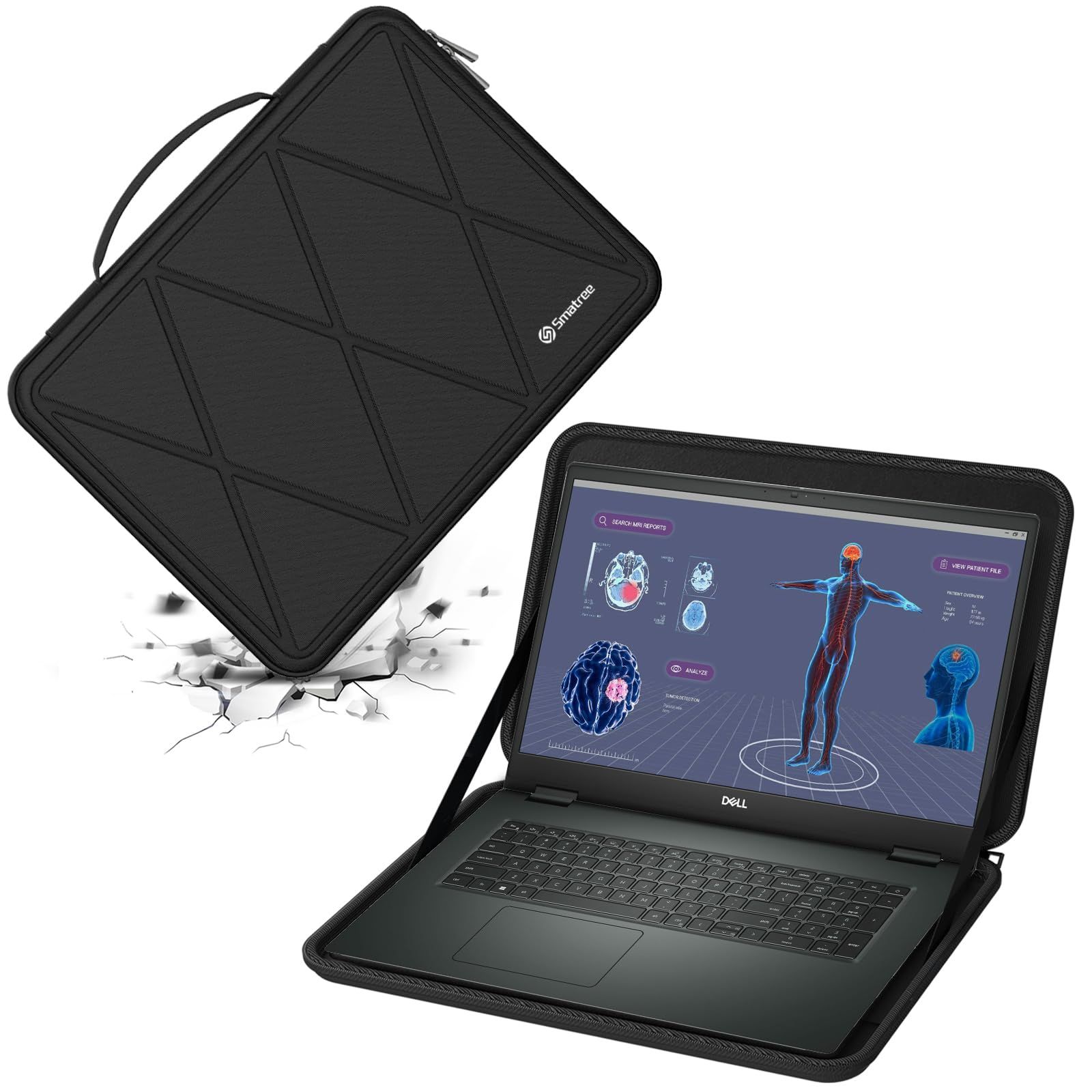 ハードEVA保護スリーブケース Smatree 17インチ DELL Precision 7780 Workstation|Precision 7770 Workstation ラップトップ ハードケース防水 360度耐衝撃 X8325