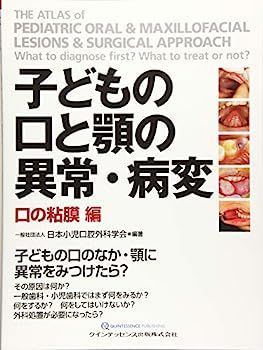 【】子どもの口と顎の異常・病変 口の粘膜 編