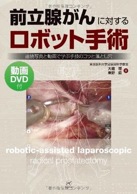 前立腺がんに対するロボット手術～連続写真と動画で学ぶ手技のコツと落とし穴～