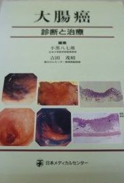 大腸癌―診断と治療 八七郎， 小黒; 茂昭， 吉田 大腸癌―診断と治療 八七郎， 小黒; 茂昭， 吉田 - メルカリ
