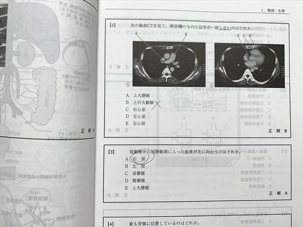 UG33-072 TECOM CBT 臓器別 病態と診断・治療 30 S3B - メルカリ