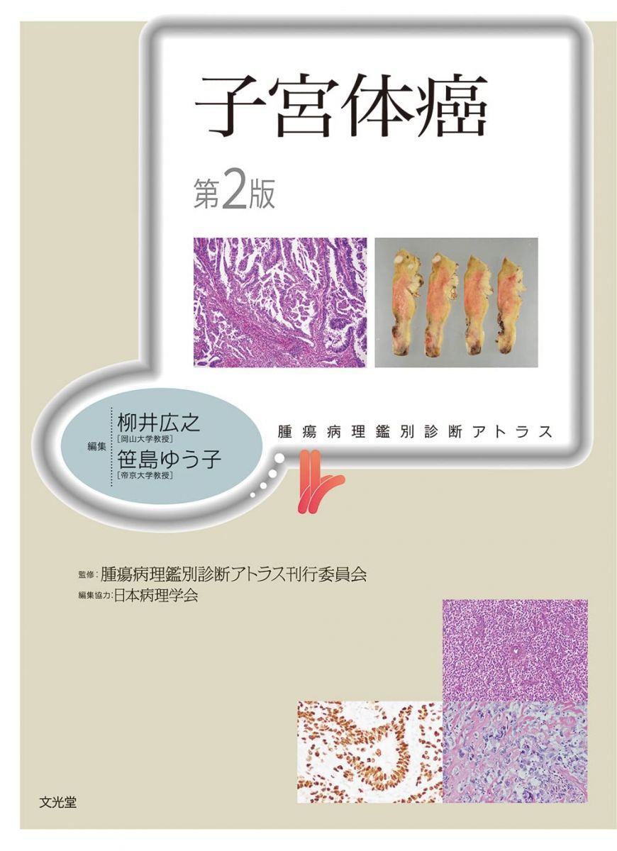 子宮体癌 第2版 (腫瘍病理鑑別診断アトラス)
