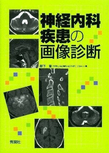 神経内科疾患の画像診断 神経内科疾患の画像診断 【公式通販】