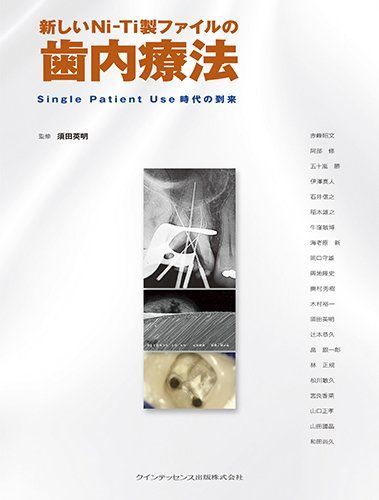 新しいNi-Ti製ファイルの歯内療法 須田 英明