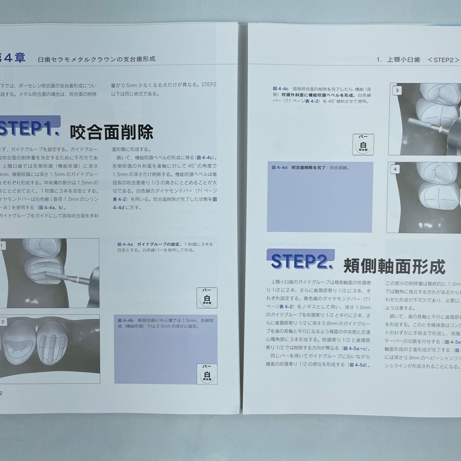 裁断済】必ず上達支台歯形成 : イラストで見るビギナーのためのバー