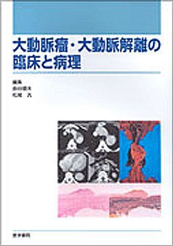 大動脈瘤 大動脈解離の臨床と病理