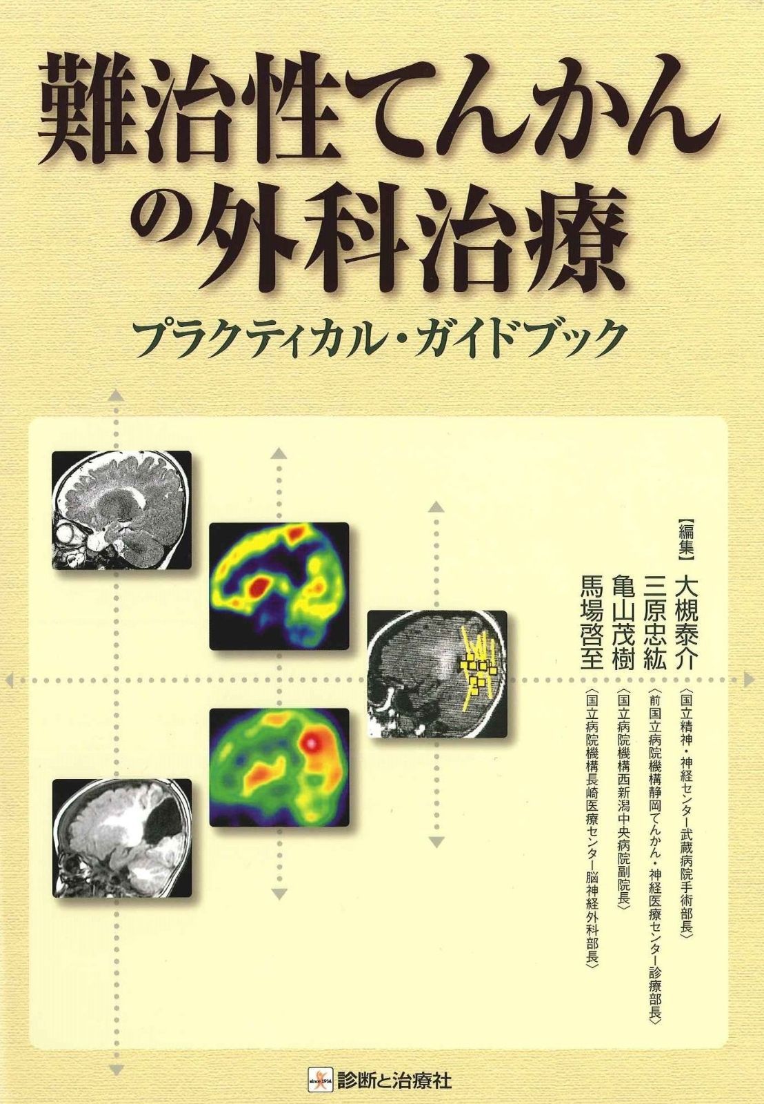 難治性てんかんの外科治療: プラクティカル・ガイドブック 【公式通販】