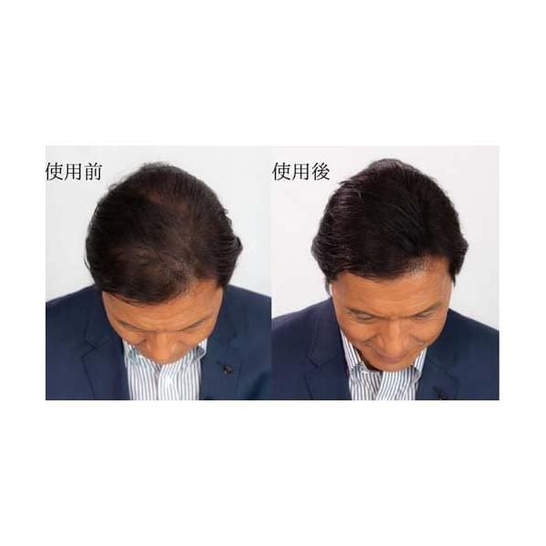 スーパーミリオンヘアー 3個