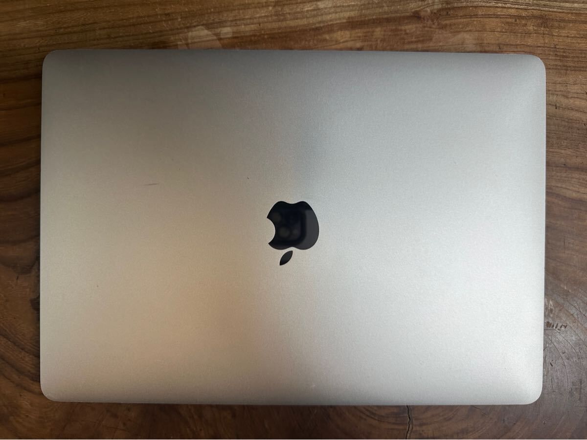Retina