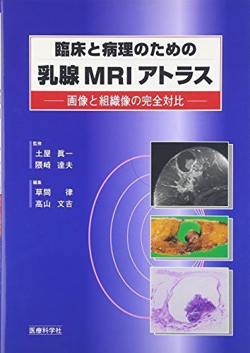 【裁断済】乳房MRIアトラス 乳房MRIアトラス【裁断済】送料 無料 通販