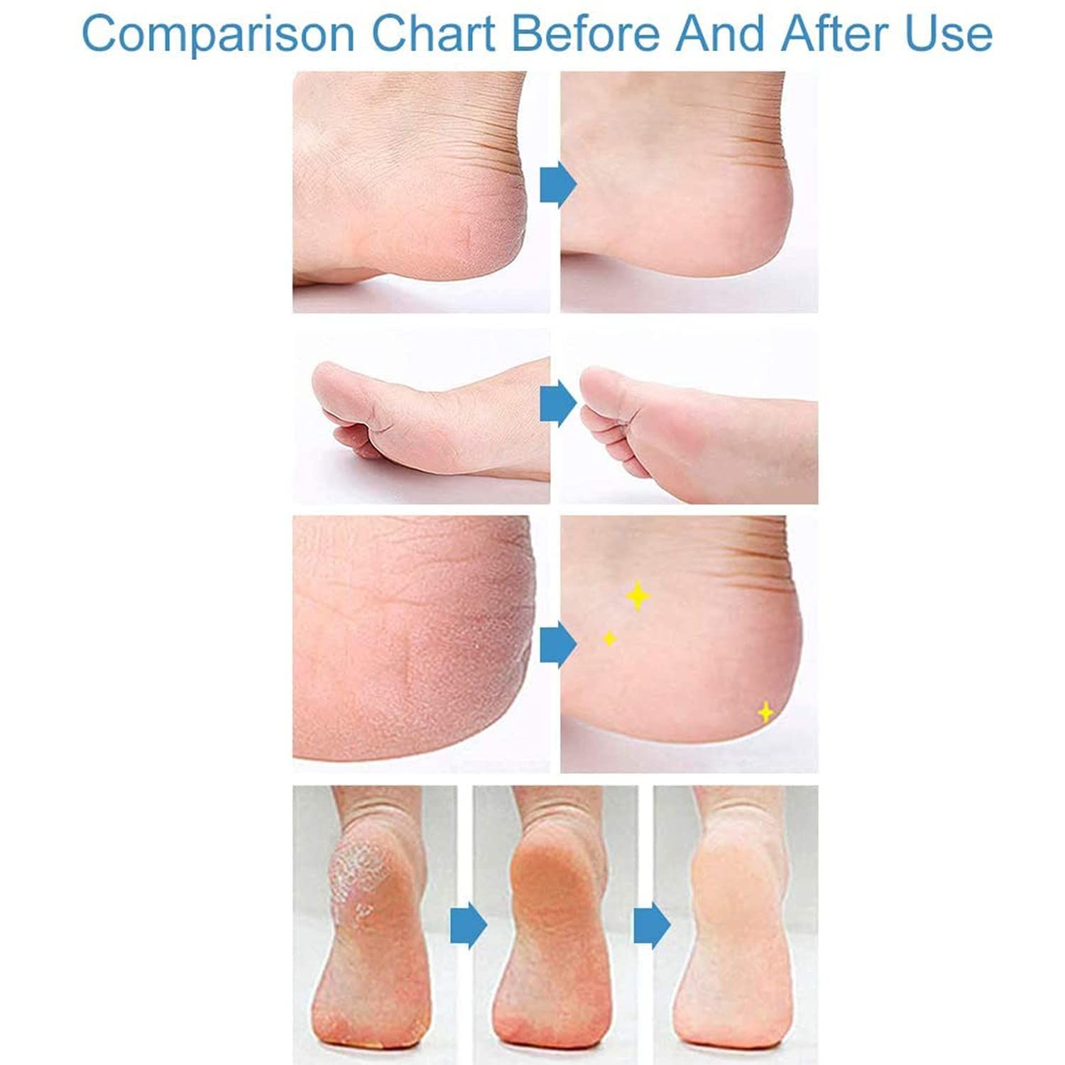 Panasonic ER240B 髭-口ひげトリマー 男性用 LAWEED_CL