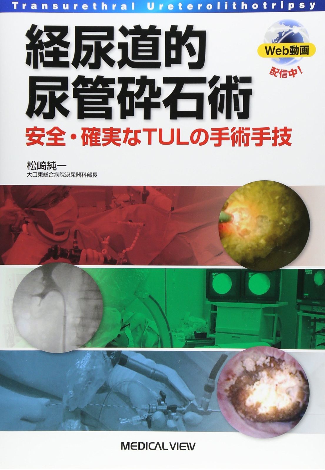 経尿道的尿管砕石術?安全 確実なTULの手術手技
