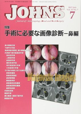 JOHNS (Vol.33 No.7(2017 July))