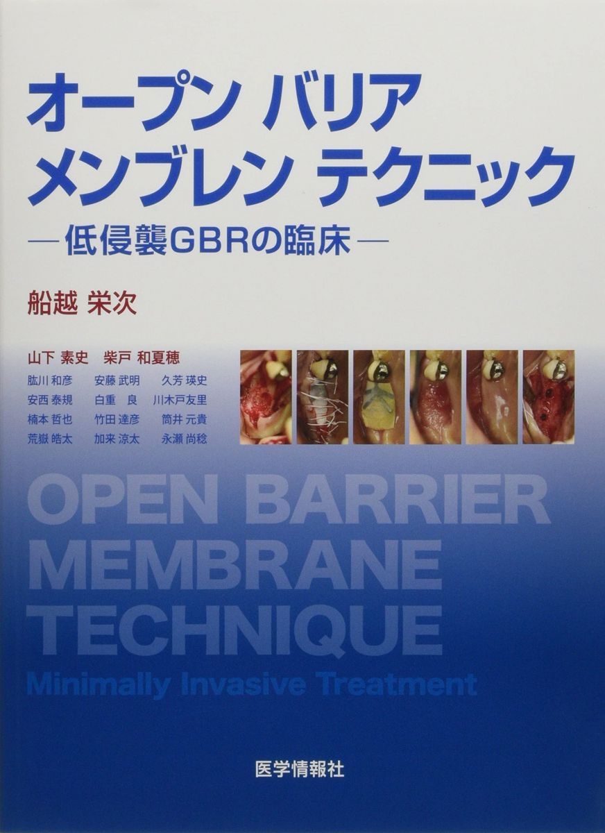 本 オープンバリアメンブレンテクニック: 低侵襲GBRの臨床
