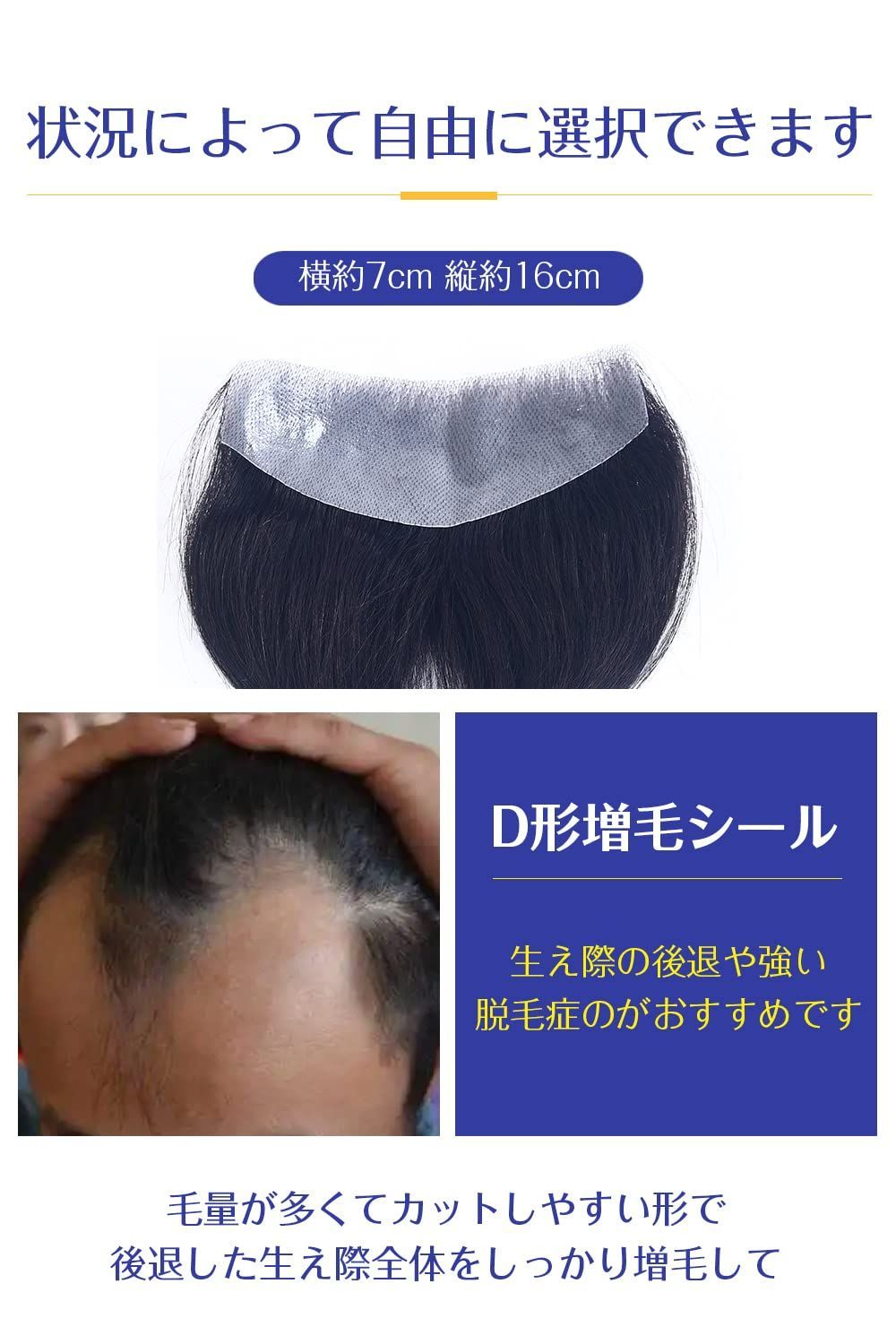 人毛100％ 脱毛症
