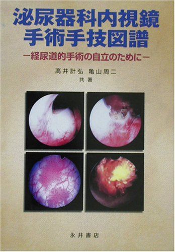 泌尿器科内視鏡手術手技図譜 高井 計弘