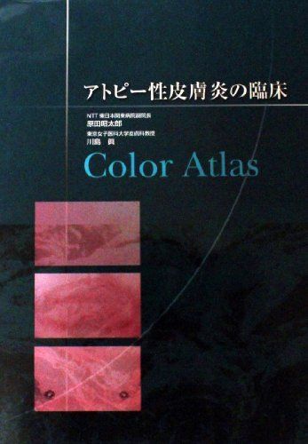 カラーアトラス　アトピー性皮膚炎の臨床 [ハードカバー] NTT東日本関東病院副院長　原田昭太郎; 東京女子医科大学皮膚科教授　川島真