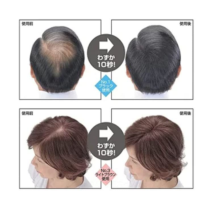 スーパーミリオンヘアー ダークブラウン ミスト 2本ずつセット 新品・未開封 Amazon | 【2点セット】スーパーミリオンヘアー 30g 約75回分