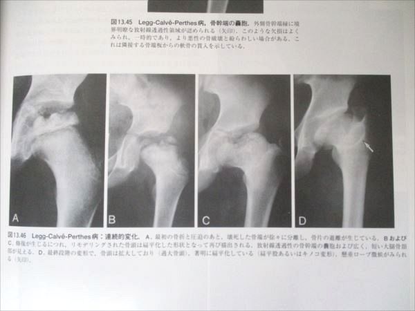 大系 骨