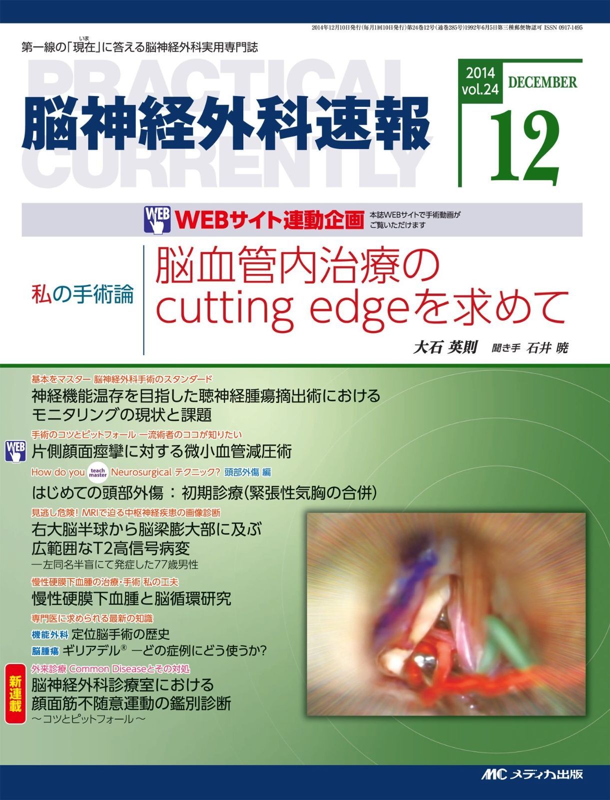 脳神経外科速報 2014年12月号(第24巻12号) 特集:脳血管内治療の
