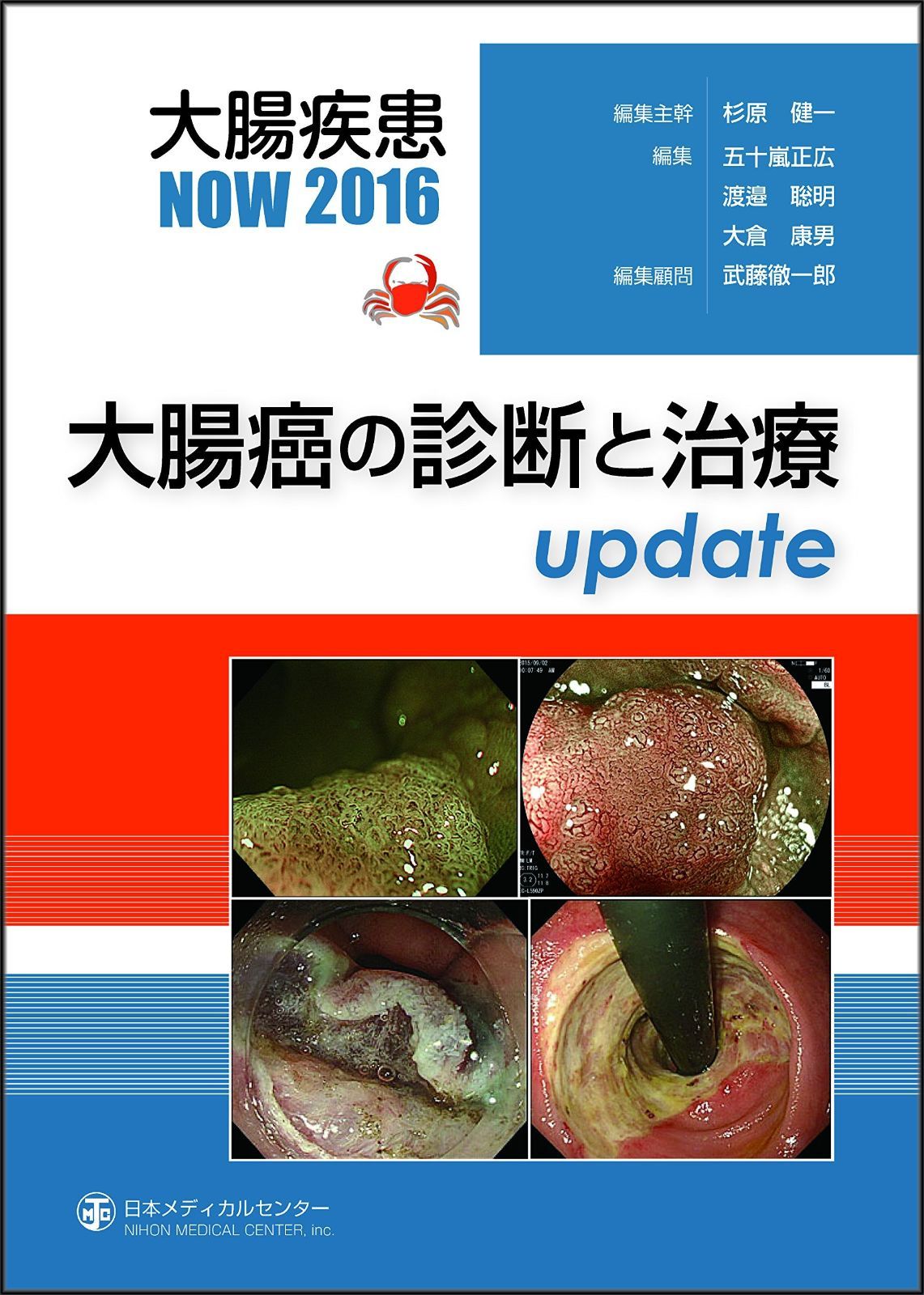 大腸癌の診断と治療update (大腸疾患NOW 2016)