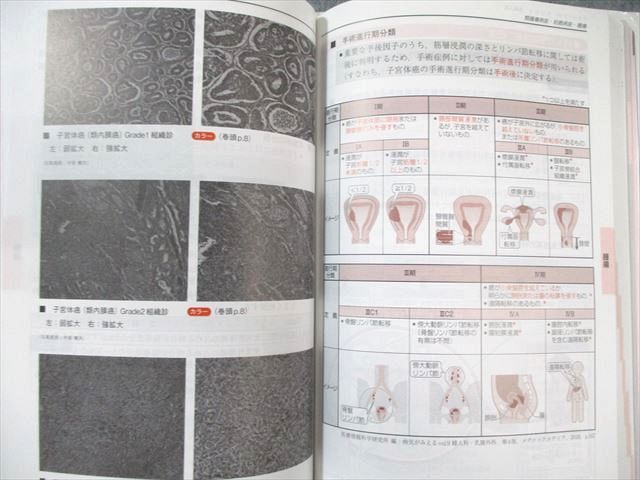 メディックメディア CBT・医師国家試験のためのレビューブック 産婦人