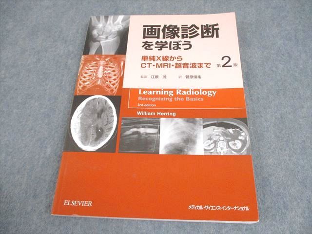 メディカル・サイエンス・インターナショナル 画像診断を学ぼう 単純X