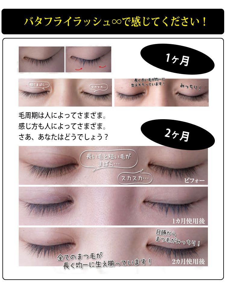 バタフライラッシュ ∞ インフィニティ 2ml - メルカリ