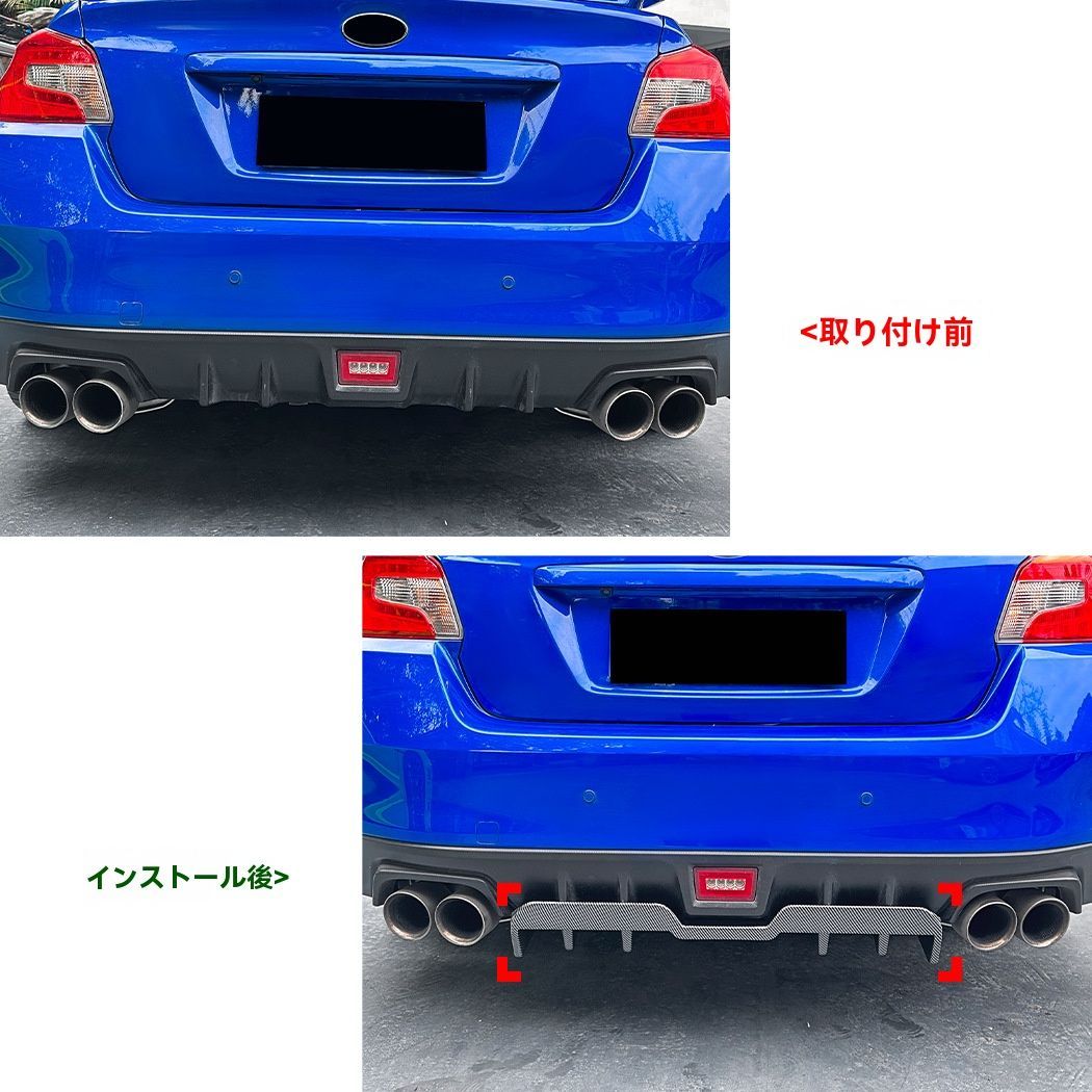 STI