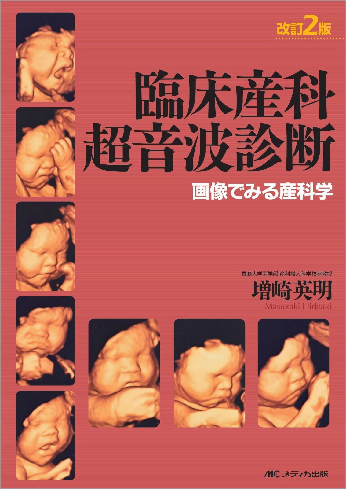 臨床産科超音波診断 改訂2版―画像でみる産科学