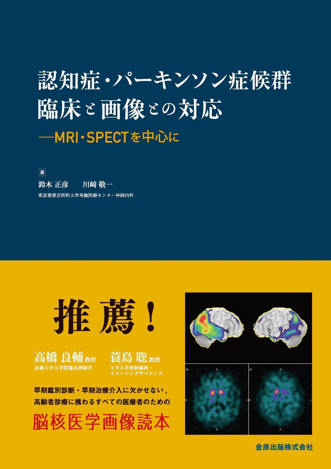 認知症 パーキンソン症候群 臨床と画像との対応 MRI SPECTを中心に