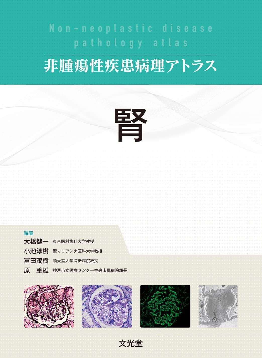 【裁断済】非腫瘍性疾患病理アトラス 消化管 消化管 (非腫瘍性疾患病理アトラス) | 九嶋 亮治, 八尾 隆史