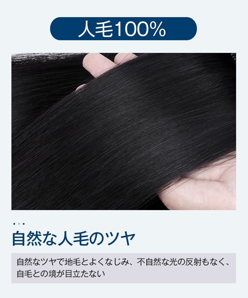 円形脱毛症隠し