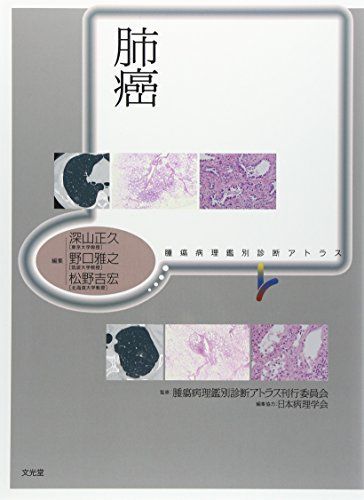 肺癌 (腫瘍病理鑑別診断アトラス) 深山 正久