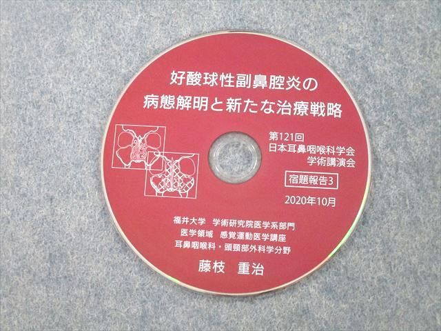 UK25-085 福井大学 学術研究院医学系部門 好酸球性副鼻腔炎の病態解明と新たな治療戦略 状態良 2020 藤枝重治 33M3D